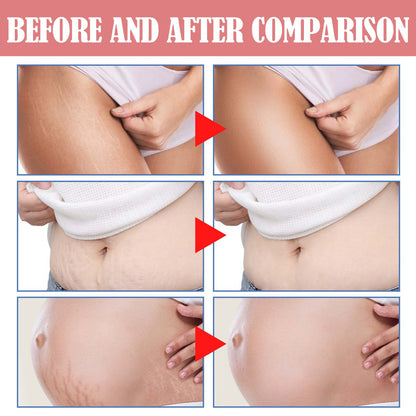 Skin Neck Cream Gentle Care Smooth Skin Firming